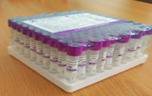 EDTA Vacutainer (Purple Top)