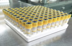 MICROPIPETTES YELLOW TIPS