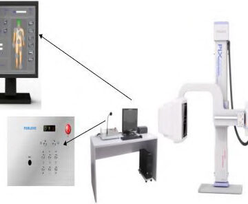 DIGITAL RADIOGRAPHY SYSTEM